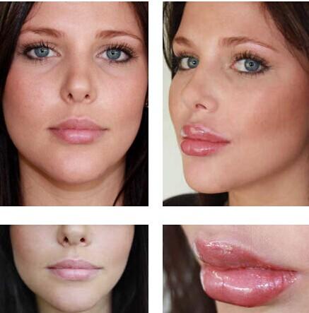 خرید پستی حجم دهنده ی لب lip pump خرید پستی حجم دهنده ی لب lip pump